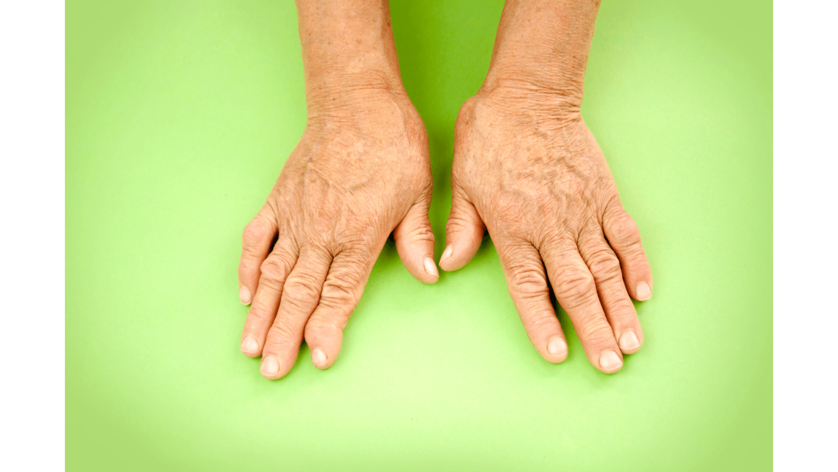 Хронических артрит руки